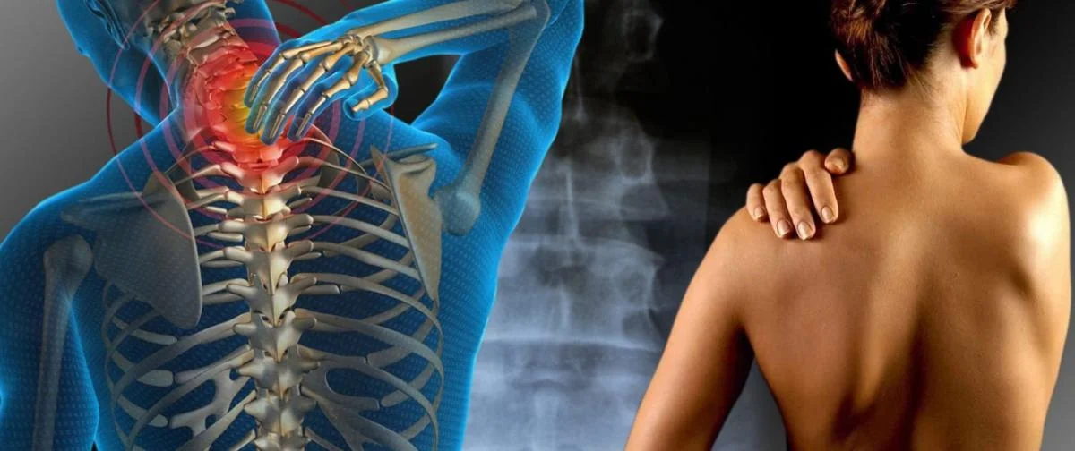 problemi schiena osteopata