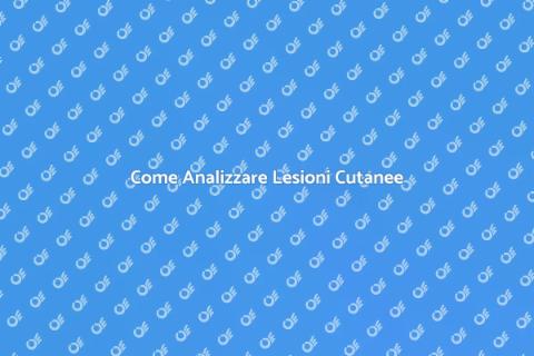 Analisi Lesioni Cutanee Sospette