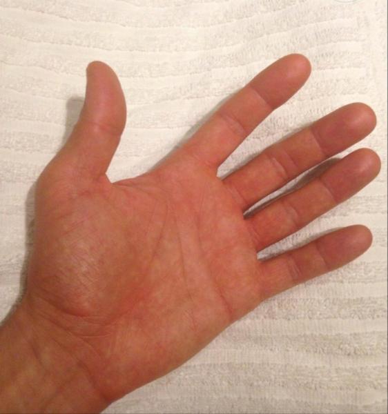 Dado Massaggi - Foto 2