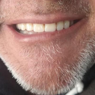 Massimiliano